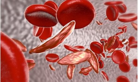 Sickle cell disease