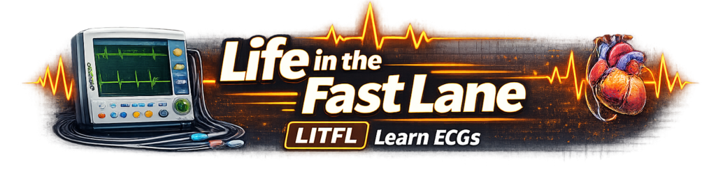 life in the fast lane